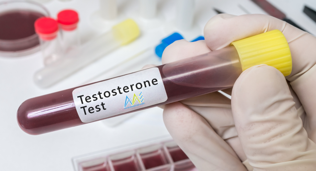 Testosterone Test testosterone lab test