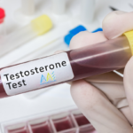 testosterone lab test