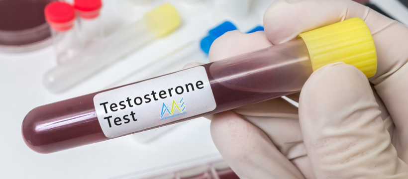 testosterone lab test